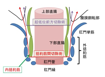 大腸イラスト（木下Dr)